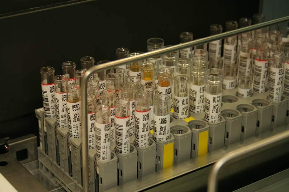 Examen de orina medir ph del cuerpo