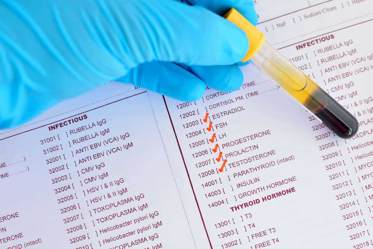 Hormone Test