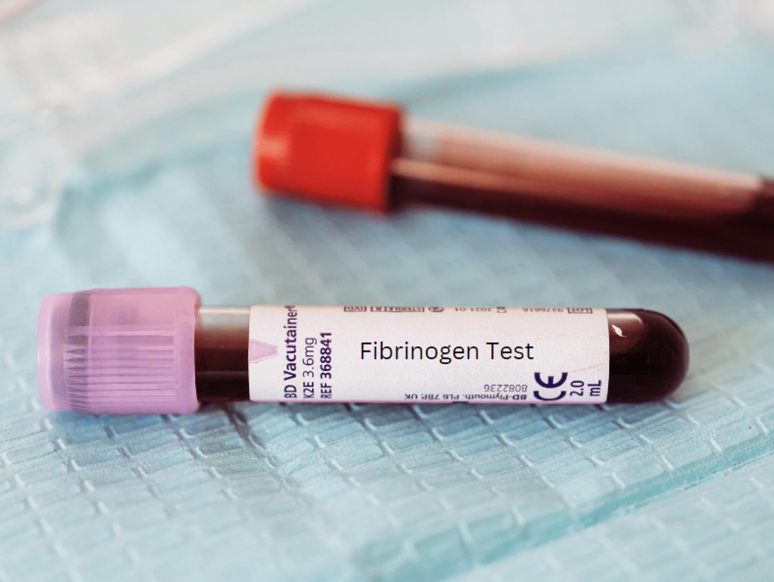 Fibrinógeno: La Proteína que Puede Salvar tu Corazón