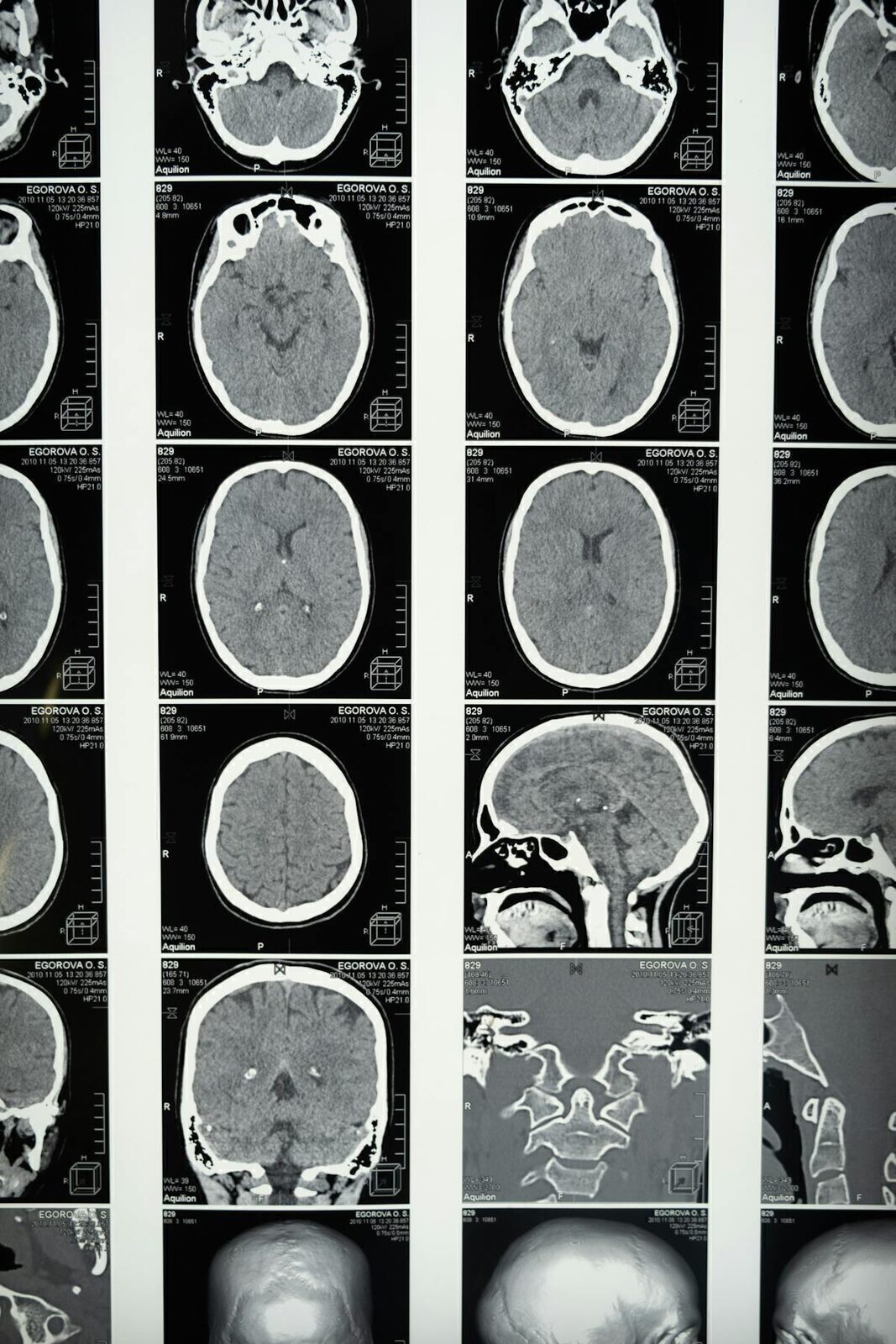 Brain Health & Cognitive Optimization: A Precision Medicine Guide