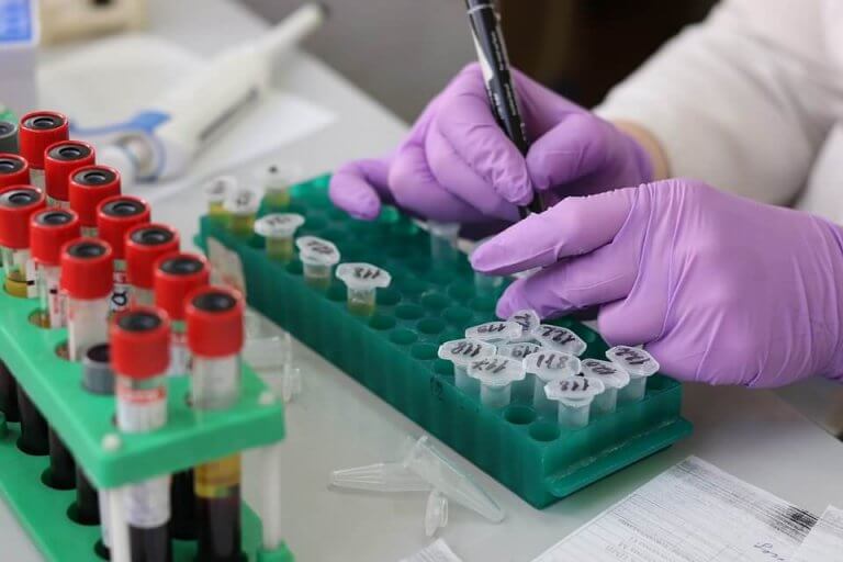 test de ph para medir en el cuerpo
