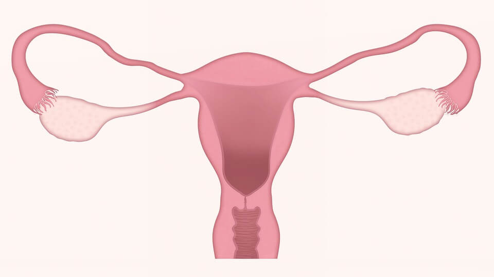 dhea mejora la endometriosis