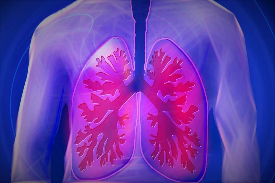 Terapia intravenosa con peróxido de hidrógeno para enfermedades respiratorias